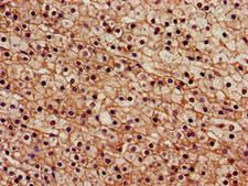SENP2 Antibody - Immunohistochemistry image of paraffin-embedded human adrenal gland tissue at a dilution of 1:100