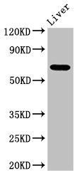 SENP2 Antibody - Positive Western Blot detected in Mouse liver tissue. All lanes: SENP2 antibody at 3.4 µg/ml Secondary Goat polyclonal to rabbit IgG at 1/50000 dilution. Predicted band size: 68, 67 KDa. Observed band size: 68 KDa