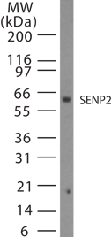 SENP2 Antibody - Western blot of SENP2 in 15 ugs of Jurkat cell lysate using antibody at 1:1000.
