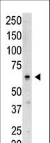 SENP3 Antibody - Western blot of SENP3 N-term polyclonal antibody in Saos-2 cell lysate. SENP3 (arrow) was detected using purified antibody. Secondary HRP-anti-rabbit was used for signal visualization with chemiluminescence.