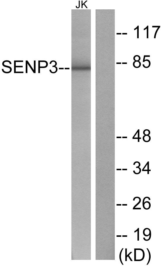 SENP3 Antibody - Western blot analysis of extracts from Jurkat cells, using SENP3 antibody.
