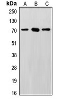 SENP3 Antibody - Western blot analysis of SENP3 expression in HeLa (A); MCF7 (B); Saos2 (C) whole cell lysates.