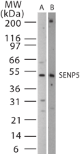 SENP5 Antibody - Western blot of SENP5 in 15 ugs of (A) Jurkat and (B) NIH3T3 cell lysate using antibody at 1:500.