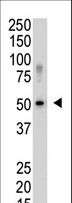 SENP5 Antibody - Western blot of SENP5 polyclonal antibody in Saos-2 cell lysate. SENP5 (Arrow) was detected using purified antibody. Secondary HRP-anti-rabbit was used for signal visualization with chemiluminescence.