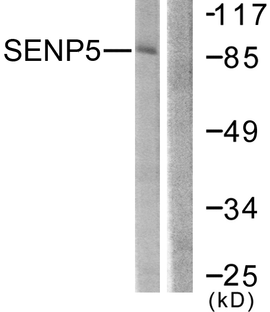 SENP5 Antibody - Western blot analysis of lysates from COS7 cells, using SENP5 Antibody. The lane on the right is blocked with the synthesized peptide.