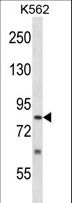 SENP5 Antibody - SENP5 Antibody western blot of K562 cell line lysates (35 ug/lane). The SENP5 antibody detected the SENP5 protein (arrow).