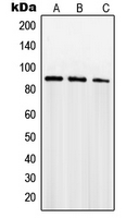 SENP5 Antibody - Western blot analysis of SENP5 expression in PC12 (A); Jurkat (B); NIH3T3 (C) whole cell lysates.