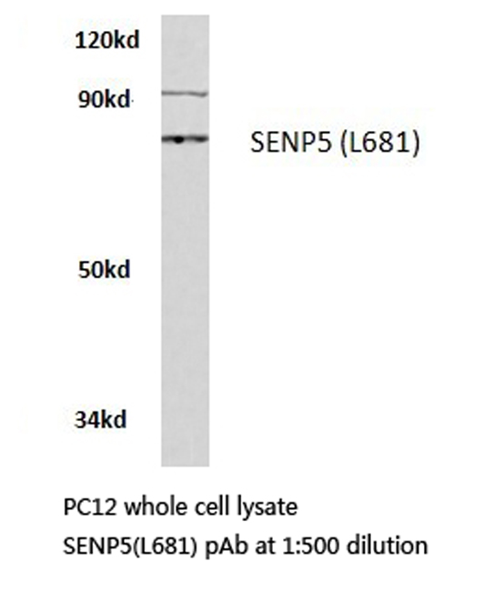 SENP5 Antibody - Western blot of SENP5 (L681) pAb in extracts from PC12 cells.