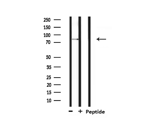 SENP5 Antibody - Western blot analysis of extracts of 293 cells using SENP5 antibody.