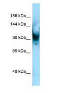 SENP6 Antibody - SENP6 antibody Western Blot of Mouse Lung.  This image was taken for the unconjugated form of this product. Other forms have not been tested.