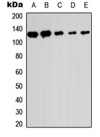 SENP6 Antibody - Western blot analysis of SENP6 expression in HEK293T (A); Raw264.7 (B); H9C2 (C); HeLa (D); HL60 (E) whole cell lysates.