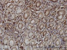 SENP6 Antibody - Immunoperoxidase of monoclonal antibody to SENP6 on formalin-fixed paraffin-embedded human stomach. [antibody concentration 3 ug/ml]