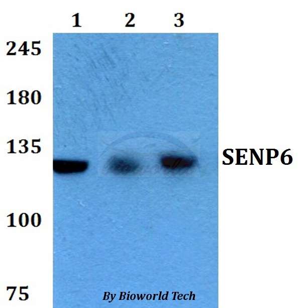 SENP6 Antibody - Western blot of SENP6 antibody at 1:500 dilution. Lane 1: HEK293T whole cell lysate. Lane 2: Raw264.7 whole cell lysate. Lane 3: H9C2 whole cell lysate.