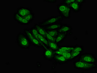 SENP6 Antibody - Immunofluorescent analysis of Hela cells diluted at 1:100 and Alexa Fluor 488-congugated AffiniPure Goat Anti-Rabbit IgG(H+L)