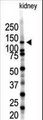 SENP7 Antibody - Western blot of SENP7 polyclonal antibody in mouse kidney tissue lysate (35 ug/lane). SENP7(arrow) was detected using the purified antibody.