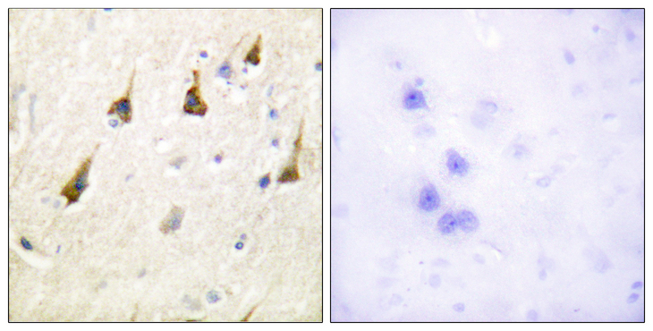 SENP7 Antibody - Immunohistochemistry analysis of paraffin-embedded human brain tissue, using SENP7 Antibody. The picture on the right is blocked with the synthesized peptide.