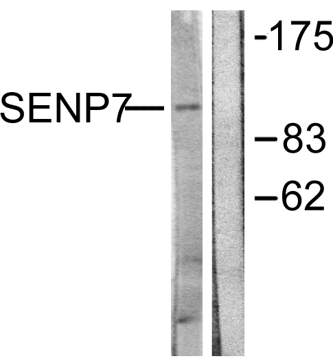 SENP7 Antibody - Western blot analysis of lysates from HUVEC cells, using SENP7 Antibody. The lane on the right is blocked with the synthesized peptide.