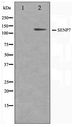 SENP7 Antibody - Western blot of HUVEC cell lysate using SENP7 Antibody
