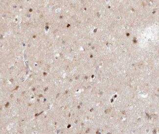 SENP7 Antibody - 1:100 staining human brain tissue by IHC-P. The tissue was formaldehyde fixed and a heat mediated antigen retrieval step in citrate buffer was performed. The tissue was then blocked and incubated with the antibody for 1.5 hours at 22°C. An HRP conjugated goat anti-rabbit antibody was used as the secondary.