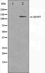 SENP7 Antibody - Western blot analysis on HuvEc cell lysates using SENP7 antibody. The lane on the left is treated with the antigen-specific peptide.
