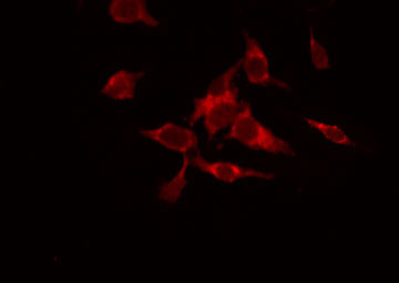 SENP7 Antibody - Staining HuvEc cells by IF/ICC. The samples were fixed with PFA and permeabilized in 0.1% Triton X-100, then blocked in 10% serum for 45 min at 25°C. The primary antibody was diluted at 1:200 and incubated with the sample for 1 hour at 37°C. An Alexa Fluor 594 conjugated goat anti-rabbit IgG (H+L) Ab, diluted at 1/600, was used as the secondary antibody.