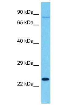 SENP8 Antibody - SENP8 antibody Western Blot of 786-0. Antibody dilution: 1 ug/ml.  This image was taken for the unconjugated form of this product. Other forms have not been tested.