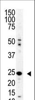 SENP8 Antibody - Western blot of SENP8 polyclonal antibody in mouse spleen lysate. SENP8 (arrow) was detected using purified antibody. Secondary HRP-anti-rabbit was used for signal visualization with chemiluminescence.