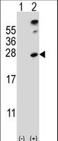 SENP8 Antibody - Western blot of SENP8 (arrow) using rabbit polyclonal SENP8 Antibody (S19). 293 cell lysates (2 ug/lane) either nontransfected (Lane 1) or transiently transfected (Lane 2) with the SENP8 gene.