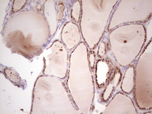 SENP8 Antibody - Immunohistochemical staining of paraffin-embedded Human thyroid tissue within the normal limits using anti-SENP8 mouse monoclonal antibody. (Heat-induced epitope retrieval by 1 mM EDTA in 10mM Tris, pH8.5, 120C for 3min,