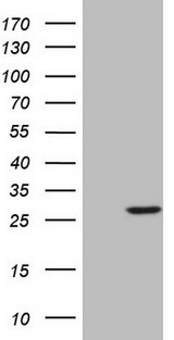 SENP8 Antibody - HEK293T cells were transfected with the pCMV6-ENTRY control (Left lane) or pCMV6-ENTRY SENP8 (Right lane) cDNA for 48 hrs and lysed. Equivalent amounts of cell lysates (5 ug per lane) were separated by SDS-PAGE and immunoblotted with anti-SENP8.
