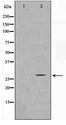 SENP8 Antibody - Western blot of HUVEC cell lysate using SENP8 Antibody