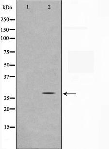 SENP8 Antibody - Western blot analysis on HuvEc cell lysates using SENP8 antibody. The lane on the left is treated with the antigen-specific peptide.