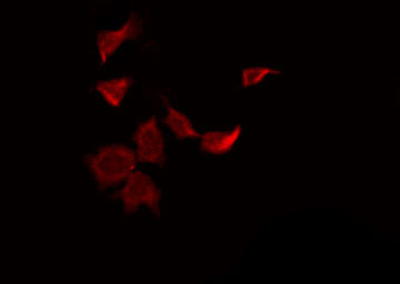 SENP8 Antibody - Staining HuvEc cells by IF/ICC. The samples were fixed with PFA and permeabilized in 0.1% Triton X-100, then blocked in 10% serum for 45 min at 25°C. The primary antibody was diluted at 1:200 and incubated with the sample for 1 hour at 37°C. An Alexa Fluor 594 conjugated goat anti-rabbit IgG (H+L) Ab, diluted at 1/600, was used as the secondary antibody.