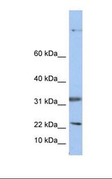 SEP15 Antibody - HepG2 cell lysate. Antibody concentration: 1.0 ug/ml. Gel concentration: 10-20%.  This image was taken for the unconjugated form of this product. Other forms have not been tested.