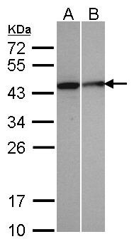 SEPHS1 / SPS Antibody - Sample (30 ug of whole cell lysate). A: A431, B: MOLT4. 12% SDS PAGE. SEPHS1 / SPS antibody diluted at 1:500