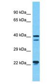 SEPHS1 / SPS Antibody - SEPHS1 / SPS antibody Western Blot of RPMI-8226. Antibody dilution: 1 ug/ml.  This image was taken for the unconjugated form of this product. Other forms have not been tested.
