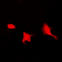 SEPHS1 / SPS Antibody - Immunofluorescent analysis of SEPHS1 staining in HeLa cells. Formalin-fixed cells were permeabilized with 0.1% Triton X-100 in TBS for 5-10 minutes and blocked with 3% BSA-PBS for 30 minutes at room temperature. Cells were probed with the primary antibody in 3% BSA-PBS and incubated overnight at 4 deg C in a humidified chamber. Cells were washed with PBST and incubated with a DyLight 594-conjugated secondary antibody (red) in PBS at room temperature in the dark.