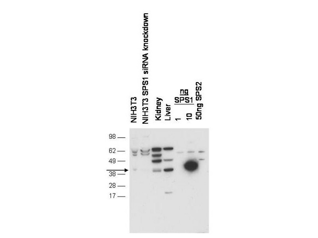 SEPHS1 / SPS Antibody - Anti-SPS1 Antibody - Western Blot. Western blot of anti-SPS1 antibody shows detection of endogenous SPS1 in NIH3T3 cell. No signal is seen in lysates from cells after pre-treatment with SPS1 siRNA. Endogenous SPS1 can be detected in mouse kidney and liver tissue lysates. Negligible cross-reactivity is seen against recombinant SPS2. The primary antibody was used at a 1:1000 dilution. Personal Communication, D. Hatfield, NCI, Bethesda, MD.