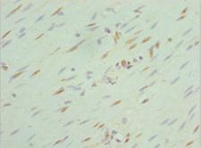 SEPHS1 / SPS Antibody - Immunohistochemistry of paraffin-embedded human colon cancer at dilution 1:100