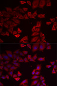 SEPHS1 / SPS Antibody - Immunofluorescence analysis of MCF7 cells using SEPHS1 antibody. Blue: DAPI for nuclear staining.