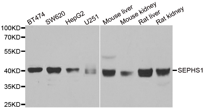 SEPHS1 / SPS Antibody - Western blot analysis of extracts of various cell lines, using SEPHS1 antibody at 1:1000 dilution. The secondary antibody used was an HRP Goat Anti-Rabbit IgG (H+L) at 1:10000 dilution. Lysates were loaded 25ug per lane and 3% nonfat dry milk in TBST was used for blocking. An ECL Kit was used for detection and the exposure time was 30s.