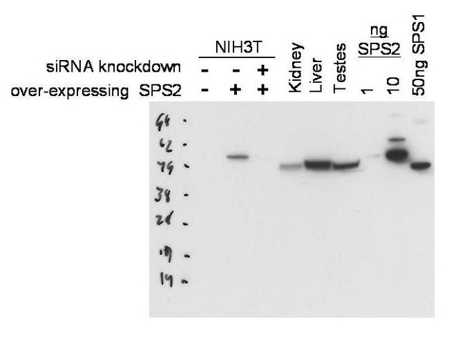 SEPHS2 Antibody - Anti-SPS2 Antibody - Western Blot. Western blot of Protein A purified anti-SPS2 antibody shows detection of SPS2 in NIH3T3 cells over-expressing this protein. No signal is seen in control lysates or in lysates from cells over-expressing the protein after pre-treatment with SPS2 siRNA. Endogenous SPS2 can be detected in mouse kidney, liver and testes tissue lysates. Partial cross-reactivity is seen against recombinant SPS1. The primary antibody was used at a 1:1000 dilution. Personal Communication, D. Hatfield, NCI, Bethesda, MD.