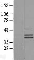 SEPHS2 Protein - Western validation with an anti-DDK antibody * L: Control HEK293 lysate R: Over-expression lysate