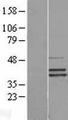 SEPHS2 Protein - Western validation with an anti-DDK antibody * L: Control HEK293 lysate R: Over-expression lysate