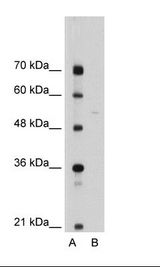 SEPSECS Antibody - A: Marker, B: Jurkat Cell Lysate.  This image was taken for the unconjugated form of this product. Other forms have not been tested.