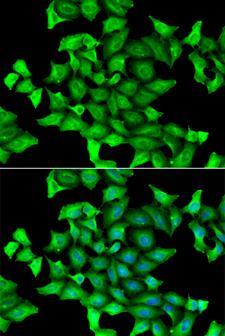 SEPSECS Antibody - Immunofluorescence analysis of HeLa cells.