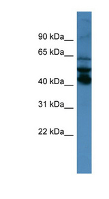 SEPT1 / Septin 1 Antibody - SEPT1 / Septin 1 antibody Western blot of NCI-H226 cell lysate.  This image was taken for the unconjugated form of this product. Other forms have not been tested.