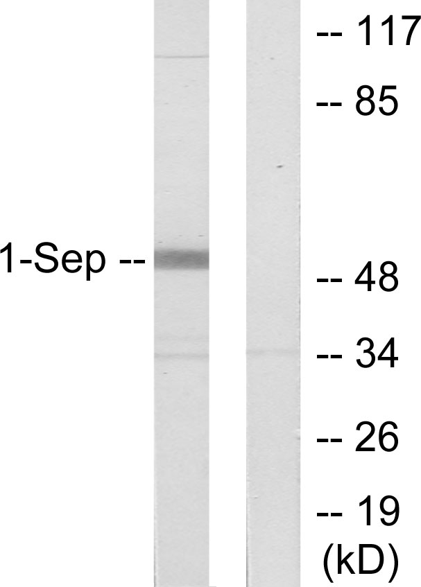 SEPT1 / Septin 1 Antibody - Western blot analysis of lysates from Jurkat cells, using SEPT1 Antibody. The lane on the right is blocked with the synthesized peptide.