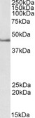 SEPT1 / Septin 1 Antibody - Goat Anti-Septin 1 / SEPT1 Antibody (2µg/ml) staining of Jurkat lysate (35µg protein in RIPA buffer). Primary incubation was 1 hour. Detected by chemiluminescencence.