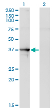 SEPT1 / Septin 1 Antibody - Western Blot analysis of SEPT1 expression in transfected 293T cell line by SEPT1 monoclonal antibody (M03), clone 1F12.Lane 1: SEPT1 transfected lysate(42 KDa).Lane 2: Non-transfected lysate.